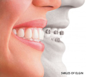 Orthodontics