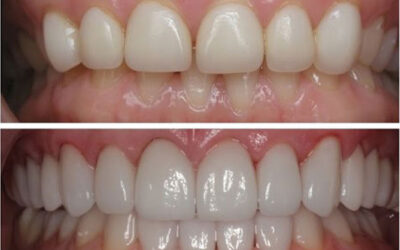 Find Low-Cost Dental Near Me for Affordable Care