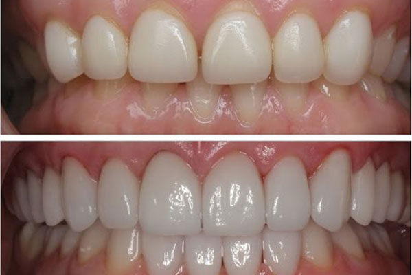 low cost dental near me low cost dental near me