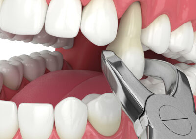 Rapid Response: Emergency Dental Office Near You