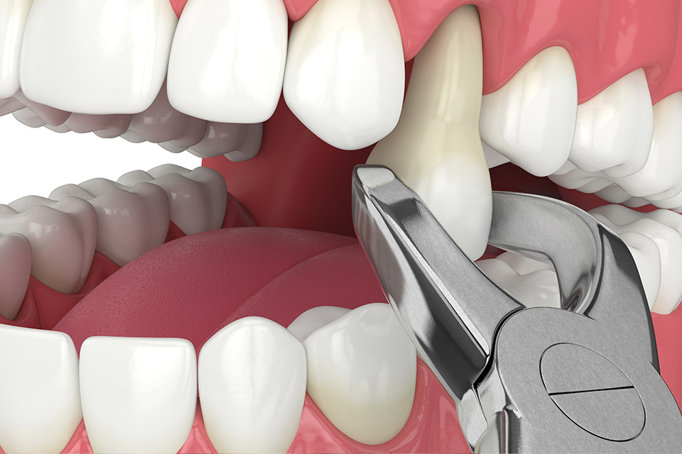 Rapid Response: Emergency Dental Office Near You Rapid Response: Emergency Dental Office Near You