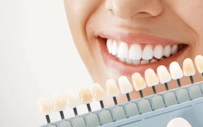 Understanding What a Dentist Charges for Teeth Whitening: A Complete Guide