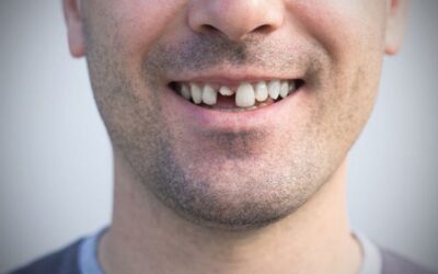 Your Ultimate Guide to Effective Broken Tooth Pain Relief
